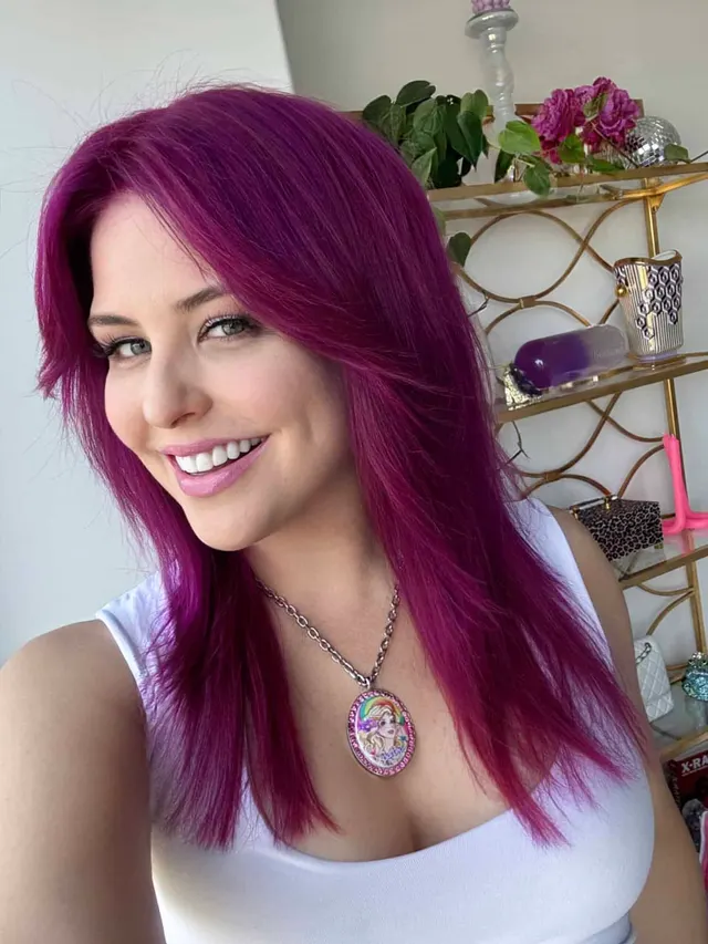 I got veneers: Temporary veneers update!